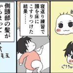 毛髪多量ベイビーのお悩みと解決策
